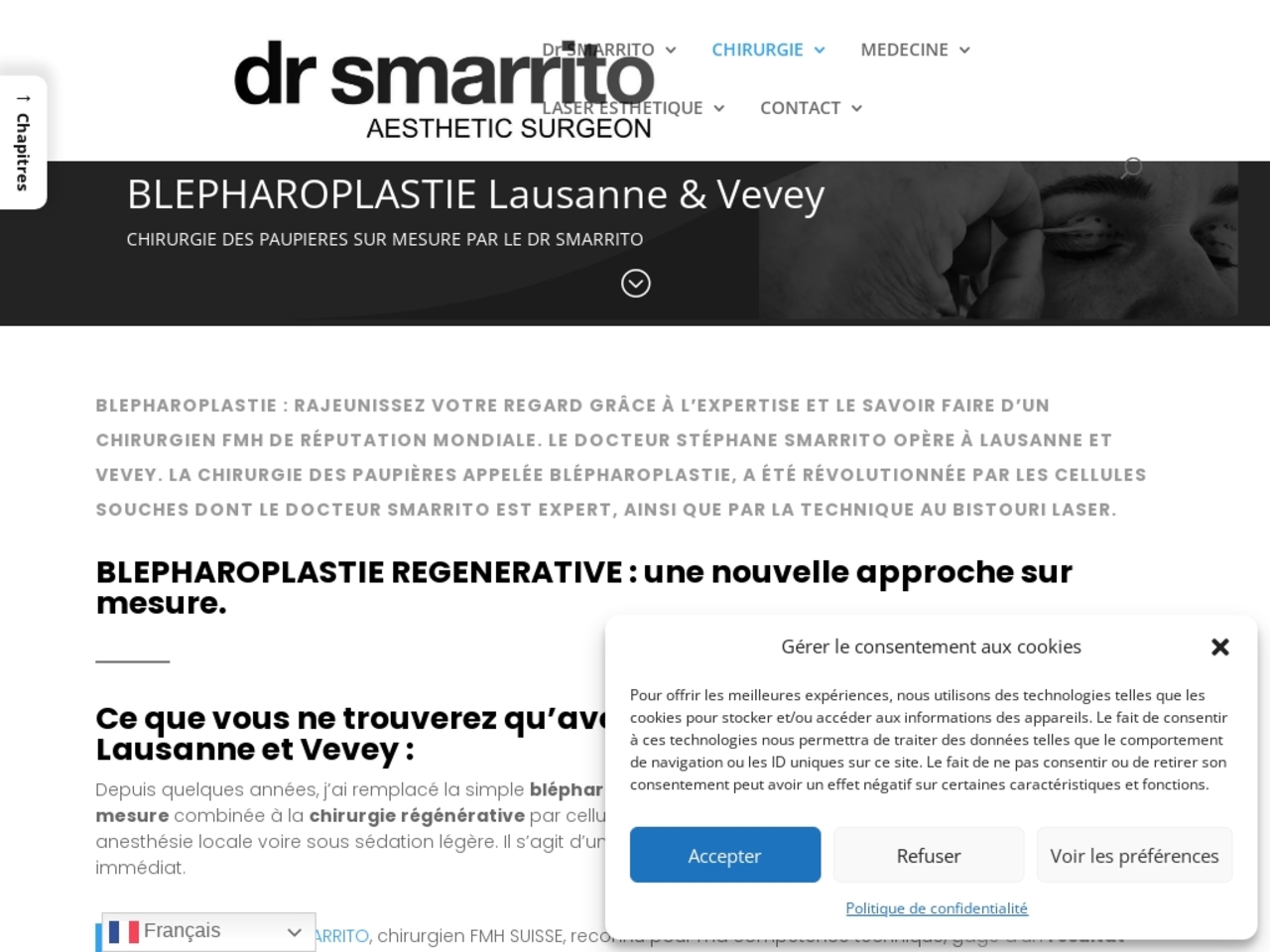 Blépharoplastie, le Docteur Smarrito de Lausanne nous dit tout